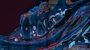 Lokalisation von Osteoklasten (grün) entlang der ossären Blutgefäße (rot) im murinen Mandibel.