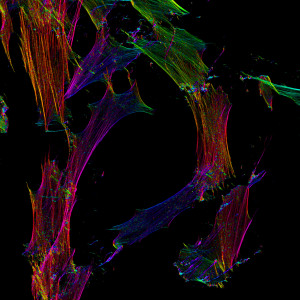 Farbkodierung der räumlichen Orientierung von Aktinfasern in humanen Fibroblasten.
