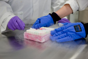 Die Arbeiten des Konsortiums werden sich auf die Proteinkinase GRK5 fokussieren, welche bisher in der Arzneimittelentwicklung wenig beachtet wurde.