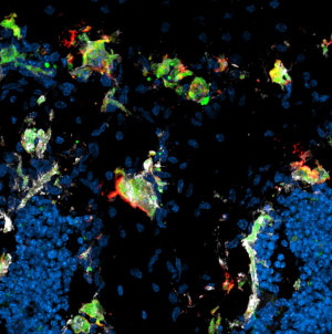 Identifizierung von resorptiv aktiven (rot, grün, weiß) und inaktiven Osteoklasten (grün, weiß) an der Wachstumsfuge und Trabekeln.
