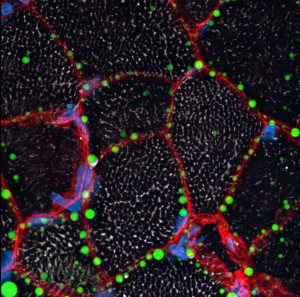 Die Färbung der neutralen Lipide (grün) und der Basalmembran (rot) ermöglicht den Nachweis von Lipidtropfen, die entlang des Endomysiums eines Patienten mit kongenitalem myasthenischem Syndrom aufgereiht sind. Die Mitochondrien (weiß) weisen geringere Mengen an neutralen Lipiden auf als das Endomysium.