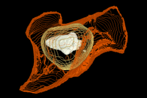 Biomedical Image Analysis.