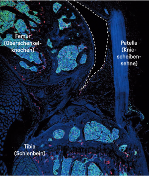 Die Aufnahme zeigt unter anderem die Synovialhöhle im Kniegelenk einer Maus.