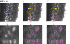 Die Abbildung zeigt die 3D-Semantiksegmentierung von Osteozyten in Mäuseknochen vor und nach der Kompression des Modells mir EfficientBioAI Die Bilder wurden mittels Lichtblatt-Fluoreszenzmikroskopie aufgenommen.