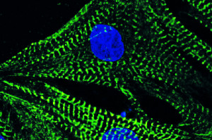 Neonatale Kardiomyozyten gefärbt mit Phalloidin: Die Abbildung zeigt Herzmuskelzellen, blau ist der Zellkern und grün das Zytoskelett.