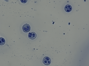 CD177 negative Neutrophile.